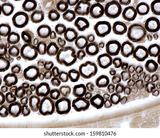 195 Myelinated Nerve Fiber Images, Stock Photos & Vectors | Shutterstock