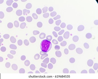 Myeloblast : Found In CML 