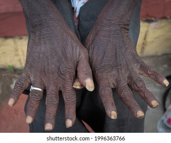 332 Picture sick old man Images, Stock Photos & Vectors | Shutterstock