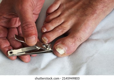 Nail care cutting toenail with fungus disease problem, fungus infects the areas between toes and the skin of the feet, it's called athlete's foot (tinea pedis) or Nail fungus disease or onychomycosis 