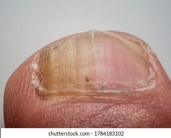 Dermatophytes Images, Stock Photos & Vectors | Shutterstock