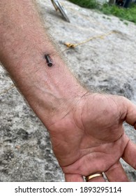 Nail In Man's Forearm From Nailgun