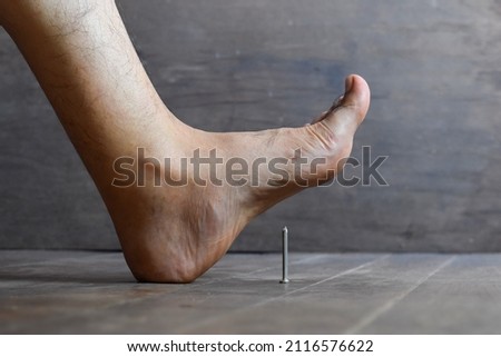 Nail prick injury in foot of Asian young man. Concept of tetanus. Stock photo © 