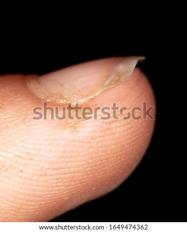 Nails with dirt on the finger isolated on a black background.