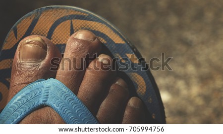 Nails of a Man's Toe Isolated