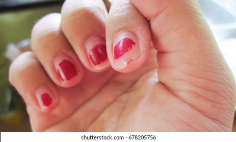 Nails ripped that do not care for delicate, no shape and do not have beautiful nail skin, indicates not to take care of both internal and external health.