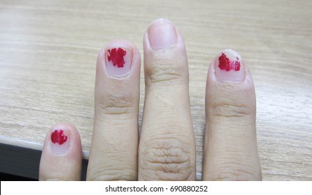 Nails That Do Not Care For Delicate, No Shape And Do Not Have Beautiful Nail Skin, Indicates Not To Take Care Of Both Internal And External Health.