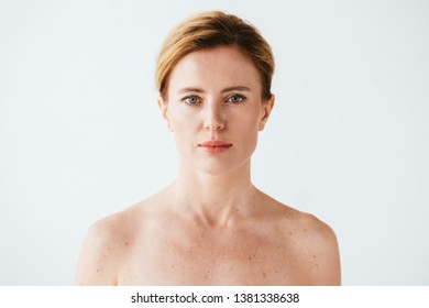 Naked Woman Skin Illness Looking Camera Stock Photo Shutterstock