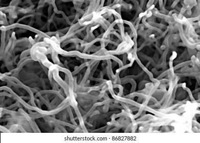 Nanotubes Bundles (real Photo From Electron Microscope)