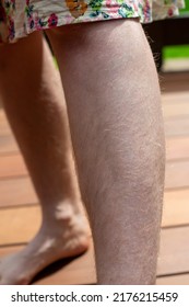 Natural Unshaved Hairy Legs Of A Body Positive Young Woman. Close Up.