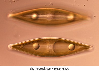 Naviculoid Pennate Diatoms, 2 Cells, One Showing Surface Of Frustule With Raphe And Pores, The Other Showing Inner Contents (lipid Droplets, Plastid, Nucleus). Light Microscope Image Of Live Cells.