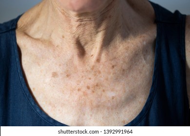 Neck Of Old Senior Citizen Woman