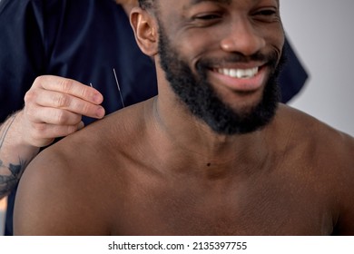needle acupuncture procedure. acupuncturist doctor makes therapy for excited black man, sit smiling, having fun, enjoying procedure treatment. cropped doctor and client in hospital clinic - Shutterstock ID 2135397755