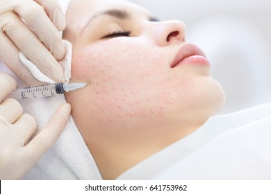 Needle mesotherapy in beauty spa salon or clinic. Cosmetics been injected to woman's face, close up portrait