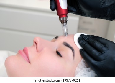 Needle mesotherapy. Cosmetologist performs needle mesotherapy on a womans face. Beautiful woman receiving microneedling rejuvenation treatment. Needle lifting
