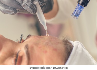 Needle Mesotherapy Treatment On A Woman Face. 