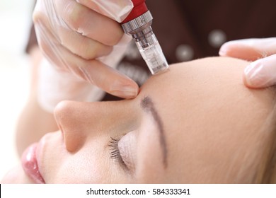 Needle mesotherapy,Microneedle mesotherapy, treatment woman at the beautician - Shutterstock ID 584333341