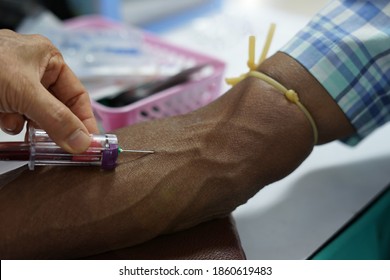 Needle Vaccuum Tube Full With Blood Samples Drawn From Patient Venous Blood Vessel, Selective Focus                              