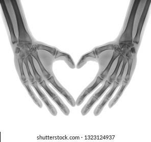 Negative X-ray - Human palms folded in a heart shape, isolated - Shutterstock ID 1323124937