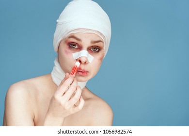 Negligence Bruises Woman Blood Swab Stock Photo (Edit Now) 1056982574