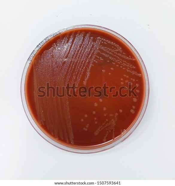 Neisseria Gonorrhoeae Gram Negative Diplococci Kidney Stock Photo (Edit ...