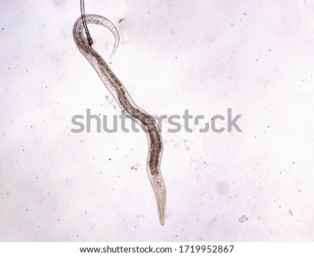 Nematode worm in the water under the microscope