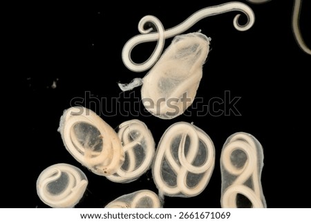 The nematodes (Nematoda), roundworms or eelworms constitute the phylum Nematoda. Species in the phylum inhabit a broad range of environments. Found in freshwater crabs.