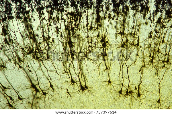 Nerve Cells Brain Stock Photo (Edit Now) 757397614