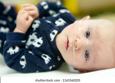 A Nervous Baby With A Breathing Tube In Their Nose Receiving Medical Treatment.