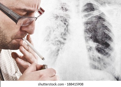 Nervous Man Is Smoking Cigarette. Smoking Causes Lung Cancer And Other Diseases.