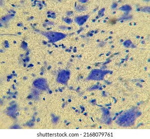 Nervous Tissue Under A Microscope. Neurocytes With Processes