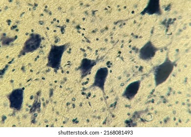 Nervous Tissue Under A Microscope. Neurocytes With Processes