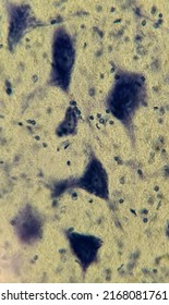 Nervous Tissue Under A Microscope. Neurocytes With Processes
