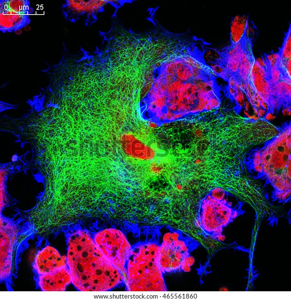 Neuroblastoma Cells Nuclei Stained Red Microfilaments Stock Photo (Edit ...