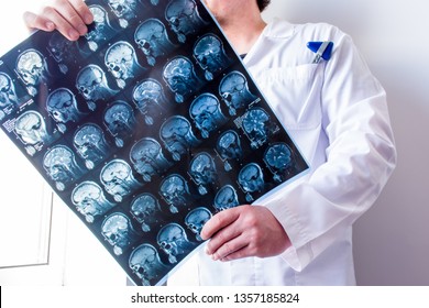 Neurologist or neurosurgeon upright holding MRI brain scanning viewing and exploring it for pathologies of central nervous system. Photo concept of MRI and CT diagnostics in neurology and neurosurgery