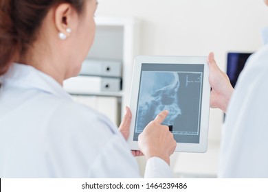 Neurologist And Radiologist Discussing Scull X-ray Of Patient On Tablet Computer In Medical Office