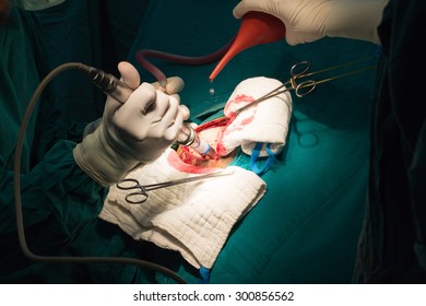 Neurology  Surgery