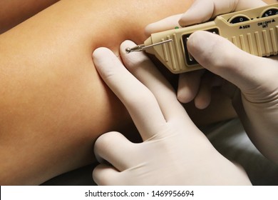 Neuromodulation Of A Trigger Point Using A Pointer Device.