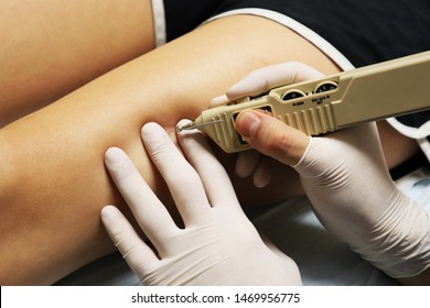 Neuromodulation Of A Trigger Point Using A Pointer Device.