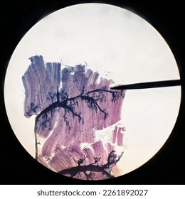 The neuromuscular junction under light microscope x10 - special staining