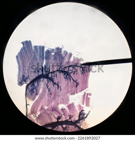 The neuromuscular junction under light microscope x10 - special staining