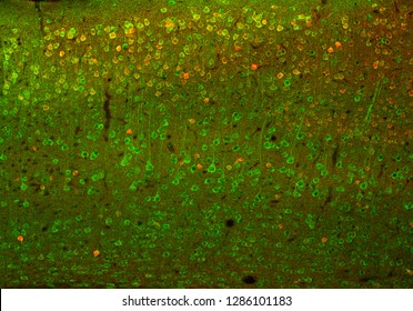 Neuronal cells in the cerebral cortex of the mouse, visualized with confocal laser scanning microscopy