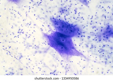 multipolar neuron labeled under microscope