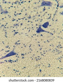 Neurons With Processes Under A Microscope. Nervous Tissue Micropreparation