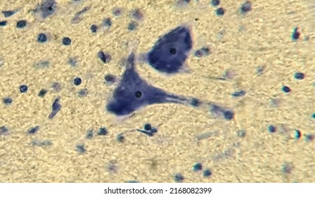 Neurons With Processes Under A Microscope. Nervous Tissue Micropreparation