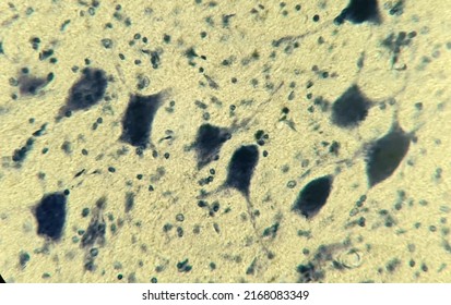 Neurons With Processes Under A Microscope. Nervous Tissue Micropreparation