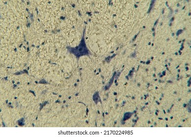 Neurons With Processes Under A Microscope. Nervous Tissue Micropreparation