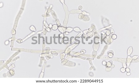 Neurospora sp. under microscope. Sample collected from corncob. Fresh sample without staining. Selective focus
