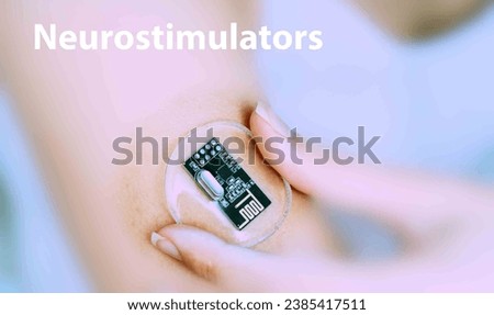 Neurostimulators: Implants that provide electrical stimulation to specific nerves or areas of the body to treat various conditions.