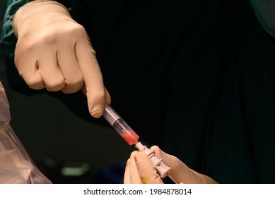 Neurosurgeon Drawing Pus From Brain Abscess In Operating Room